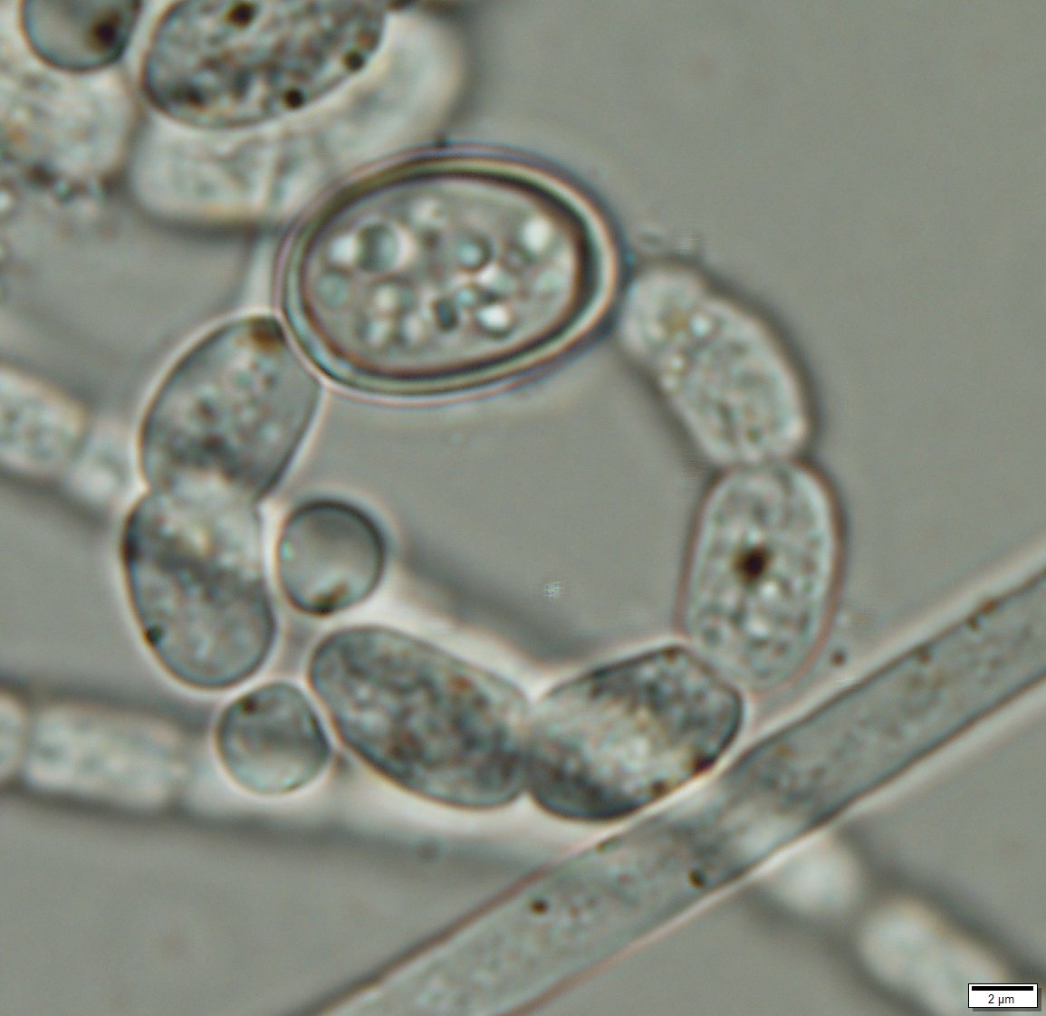 Artículo | La importancia de usar el biovolumen en estudios de fitoplancton y monitoreo ambiental de cianobacterias
